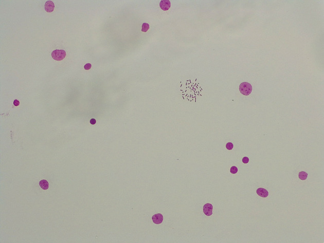 Male Chromosomes Slides - Male Chromosomes 06 100X